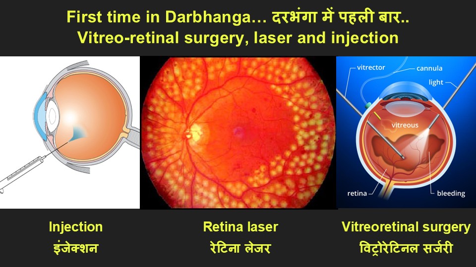 Vitreoretinal surgery, Laser and injection